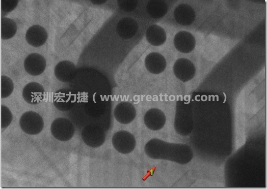 BGA因為焊墊變小，造成錫膏過多而最終形成焊接短路的結果。